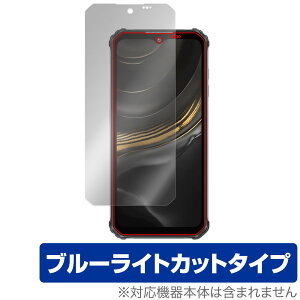 OUKITEL WP22 ی tB OverLay Eye Protector for IELe X}[gtH tی ڂɗD u[CgJbg