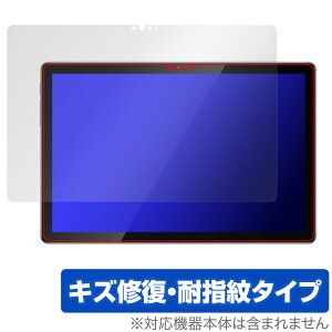 Blackview Tab 12 Pro ی tB OverLay Magic ubNr[ ^ubg tی C ώw wh~ R[eBO