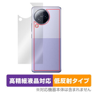 Xiaomi Civi 3 w ی tB OverLay Plus Lite for VI~[ Civi3 X}[gtH {̕یtB 炳Gᔽˑf