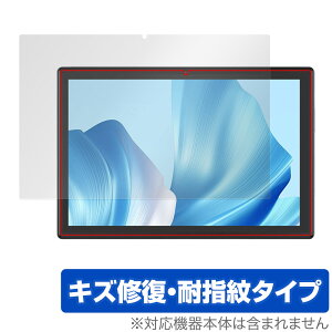 CHUWI Hi10 Xpro ی tB OverLay Magic c[EFC ^ubg tی C ώw wh~ R[eBO