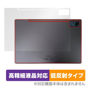 CHUWI Hi10 Xpro w ی tB OverLay Plus Lite c[EFC ^ubg {̕یtB 炳Gᔽˑf