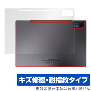 CHUWI Hi10 Xpro w ی tB OverLay Magic c[EFC ^ubg {̕یtB C wh~ R[eBO