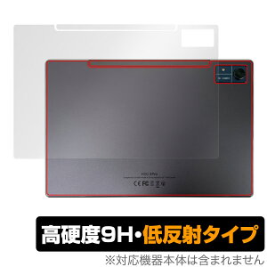 CHUWI Hi10 Xpro w ی tB OverLay 9H Plus c[EFC ^ubg 9Hdx 炳G蔽˖h~