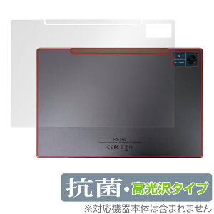 CHUWI Hi10 Xpro w ی tB OverLay R Brilliant c[EFC ^ubg Hydro Ag+ R RECX ^Cv