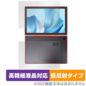 CHUWI Hi10 Xpro \ w tB OverLay Plus Lite c[EFC ^ubg \ʁEwʃZbg ׉tΉ A`OA ˖h~