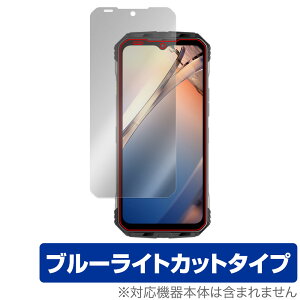 DOOGEE S100 Pro ی tB OverLay Eye Protector for hD[W[ S100Pro X}[gtH X}z tی u[CgJbg