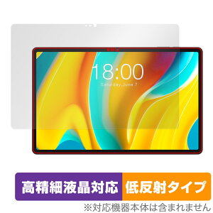 Teclast T50 Pro �ی� �t�B���� OverLay Plus Lite for �e�N���X�g T50 �v�� �^�u���b�g �t���ی� �����׉t���Ή� �A���`�O���A ���˖h�~
