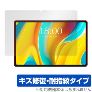 Teclast T50 Pro �ی� �t�B���� OverLay Magic for �e�N���X�g T50 �v�� �^�u���b�g �t���ی� ���C�� �ώw�� �w��h�~ �R�[�e�B���O