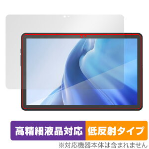 AGM PAD P1 ی tB OverLay Plus Lite for AGM PAD P1 ^ubg tablet tی ׉tΉ A`OA ˖h~