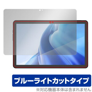 AGM PAD P1 ی tB OverLay Eye Protector for AGM PAD P1 ^ubg tablet tی ڂɗD u[CgJbg