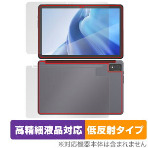 AGM PAD P1 \ w tB OverLay Plus Lite for AGM PAD P1 ^ubg \ʁEwʃZbg ׉tΉ A`OA ˖h~