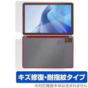 AGM PAD P1 \ w tB OverLay Magic for AGM PAD P1 ^ubg tablet \ʁEwʃZbg C ώw wh~ R[eBO