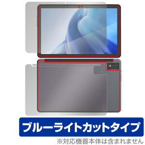 AGM PAD P1 \ w tB OverLay Eye Protector for AGM PAD P1 ^ubg \ʁEwʃZbg ڂɗD u[CgJbg