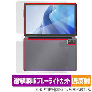 AGM PAD P1 \ w tB OverLay Absorber ᔽ for AGM PAD P1 ^ubg \ʁEwʃZbg Ռz u[CgJbg R