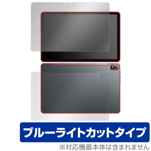 Blackview Tab 16 �\�� �w�� �Z�b�g �ی�t�B���� OverLay Eye Protector �u���b�N�r���[ �^�u���b�g �ڂɗD���� �u���[���C�g�J�b�g