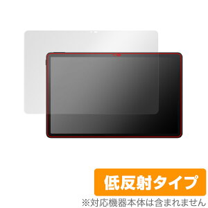 TCL TAB 11 (9466X3) ی tB OverLay Plus eB[V[G ^ubg TCLTAB11 tی A`OA ˖h~  wh~