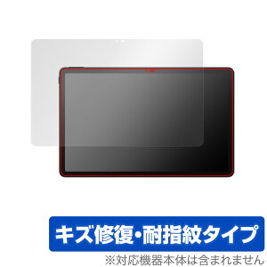 TCL TAB 11 (9466X3) ی tB OverLay Magic eB[V[G ^ubg TCLTAB11 tی C ώw wh~ R[eBO