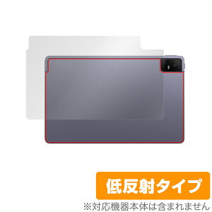 TCL TAB 11 (9466X3) w ی tB OverLay Plus eB[V[G ^ubg TCLTAB11 {̕یtB 炳Gᔽˑf