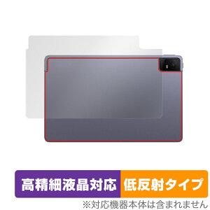 TCL TAB 11 (9466X3) w ی tB OverLay Plus Lite eB[V[G ^ubg TCLTAB11 {̕ی 炳Gᔽˑf