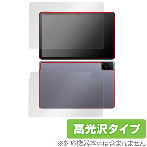 TCL TAB 11 (9466X3) \ w tB OverLay Brilliant eB[V[G ^ubg TCLTAB11 \ʁEwʃZbg wh~ 