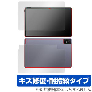 TCL TAB 11 (9466X3) \ w tB OverLay Magic eB[V[G ^ubg TCLTAB11 \ʁEwʃZbg C ώw wh~