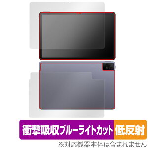 TCL TAB 11 (9466X3) \ w tB OverLay Absorber ᔽ ^ubg \ʁEwʃZbg Ռz u[CgJbg R