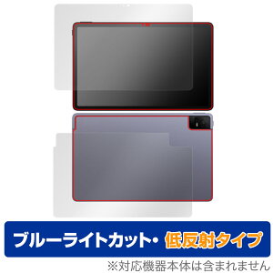 TCL TAB 11 (9466X3) \ w tB OverLay Eye Protector ᔽ ^ubg TCLTAB11 \ʁEwʃZbg u[CgJbg