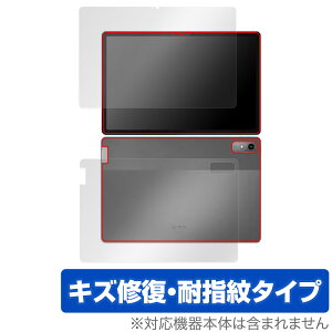 Lenovo Tab P12 �\�� �w�� �t�B���� OverLay Magic ���m�{ Android �^�u���b�g�p�ی�t�B���� �\�ʁE�w�ʃZ�b�g ���C�� �ώw�� �w��h�~
