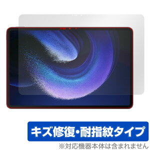 Xiaomi Pad 6 Max 14 �ی� �t�B���� OverLay Magic �V���I�~ �p�b�h �^�u���b�g�p�ی�t�B���� �t���ی� ���C�� �ώw�� �w��h�~