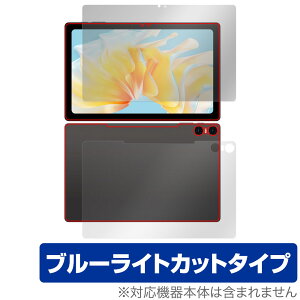 Teclast T40 Air \ w tB OverLay Eye Protector eNXg ^ubgpیtB \ʁEwʃZbg u[CgJbg