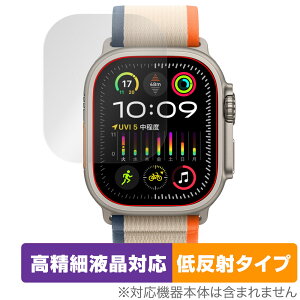 Apple Watch Ultra 2 (49mm) یtB OverLay Plus Lite AbvEHb`p X}[gEHb` ׉tΉ A`OA ᔽ