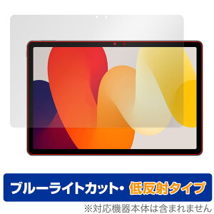 Xiaomi Redmi Pad SE ی tB OverLay Eye Protector ᔽ VI~[ ^ubgp h~ pbh tی u[CgJbg