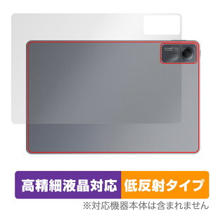 Xiaomi Redmi Pad SE w ی tB OverLay Plus Lite VI~[ ^ubgpیtB h~ pbh 炳G ᔽ