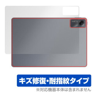 Xiaomi Redmi Pad SE w ی tB OverLay Magic VI~[ ^ubgpیtB h~ pbh {̕ی C wh~