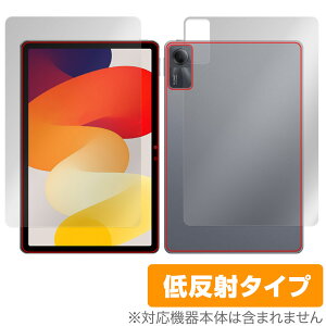 Xiaomi Redmi Pad SE \ w tB OverLay Plus VI~[ h~ pbh \ʁEwʃZbg A`OA ᔽ wh~