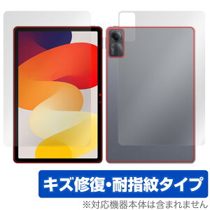 Xiaomi Redmi Pad SE \ w tB OverLay Magic VI~[ h~ pbh \ʁEwʃZbg C ώw wh~