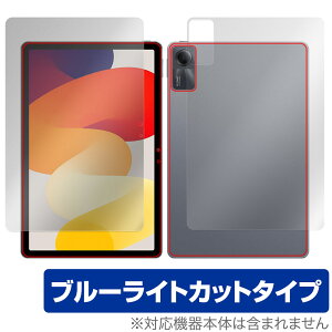Xiaomi Redmi Pad SE \ w tB OverLay Eye Protector VI~[ h~ pbh \ʁEwʃZbg u[CgJbg