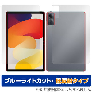 Xiaomi Redmi Pad SE \ w tB OverLay Eye Protector ᔽ VI~[ h~ pbh \ʁEwʃZbg u[CgJbg