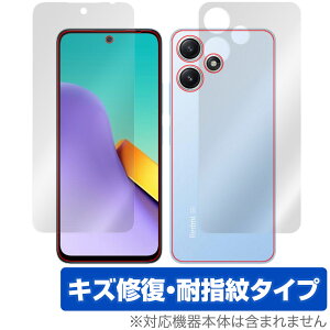 Xiaomi Redmi 12 5G \ w tB OverLay Magic VI~[ h~ 12 X}zpیtB \ʁEwʃZbg C wh~