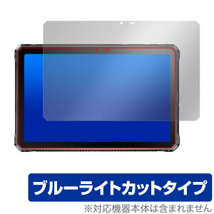DOOGEE R10 ی tB OverLay Eye Protector hD[W[ ^ubgpیtB tی ڂɗD u[CgJbg