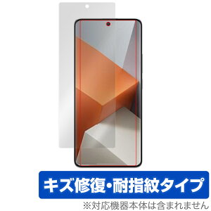 Xiaomi Redmi Note 13 Pro+ 5G ی tB OverLay Magic for VI~ X}[gtH C ώw wh~ R[eBO