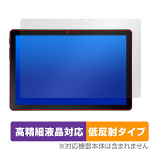 ALLDOCUBE iPlay 50S ی tB OverLay Plus Lite for I[hL[u ^ubg ׉tΉ A`OA ˖h~ 