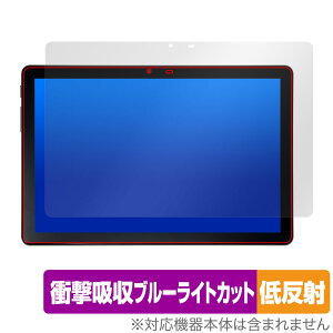 ALLDOCUBE iPlay 50S ی tB OverLay Absorber ᔽ for I[hL[u ^ubg Ռz ᔽ u[CgJbg R