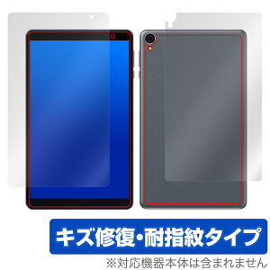 ALLDOCUBE iPlay 50 mini Lite \ w tB OverLay Magic for I[hL[u ^ubg \ʁEw C ώw wh~