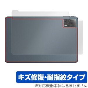 DOOGEE T20S �w�� �ی� �t�B���� OverLay Magic �h�D�[�W�[ T20S �^�u���b�g�p�ی�t�B���� �{�̕ی�t�B���� ���C�� �w��h�~