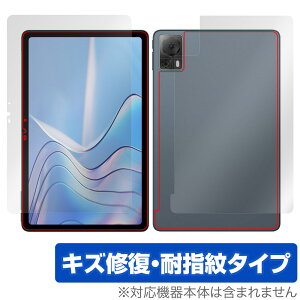 DOOGEE T20S �\�� �w�� �t�B���� OverLay Magic �h�D�[�W�[ T20S �^�u���b�g�p�ی�t�B���� �\�ʁE�w�ʃZ�b�g ���C�� �ώw�� �w��h�~