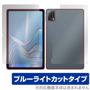 DOOGEE T20S �\�� �w�� �t�B���� OverLay Eye Protector �h�D�[�W�[ T20S �^�u���b�g�p�ی�t�B���� �\�ʁE�w�ʃZ�b�g �u���[���C�g�J�b�g