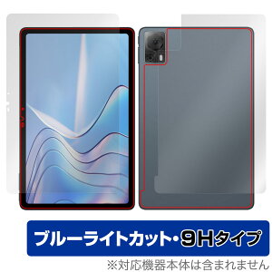 DOOGEE T20S \ w tB OverLay Eye Protector 9H ^ubgpیtB \ʁEwʃZbg 9Hdx u[CgJbg