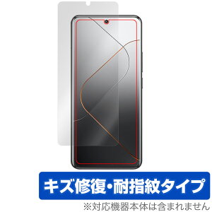 Xiaomi 14 Pro �ی� �t�B���� OverLay Magic �V���I�~ Xiaomi14Pro �X�}�z�p�ی�t�B���� �t���ی� ���C�� �ώw�� �w��h�~ �R�[�e�B���O