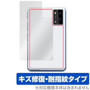 Allingo TG w ی tB OverLay Magic I[S TG |@pیtB {̕ی C wh~ R[eBO